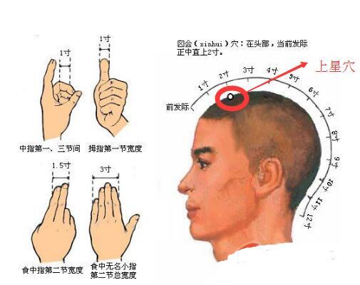 失眠感冒怎么回事 (失眠感冒怎么治疗)