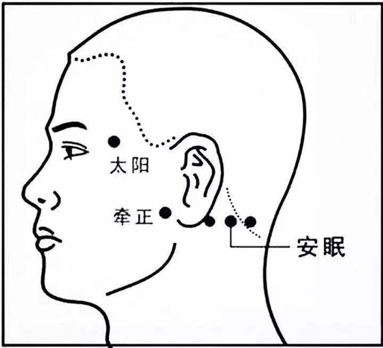 失眠耳鸣怎么办最快最有效 (失眠加耳鸣怎么治疗)