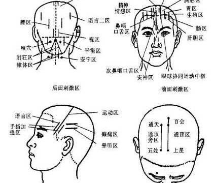 治疗失眠的针灸部位有哪些? (治疗失眠的针灸视频)