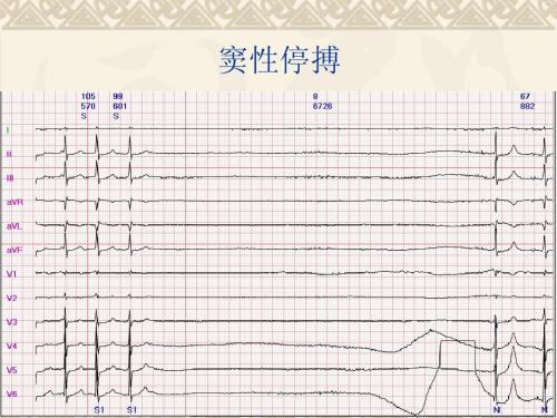 抑郁间歇性发作怎么办